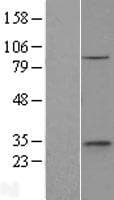 ETNK1 / Ethanolamine Kinase 2 Protein (Over-Expression Lysate Myc-DDK (Flag))