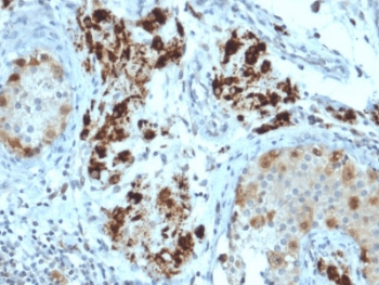 Monoclonal Mouse anti-Human STAR Antibody (clone STAR/2154, Azide-free,BSA-free, IHC)