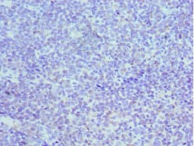 MCM3 Antibody (aa1-295)