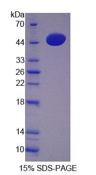 Human CALU / Calumenin Protein (Recombinant His-T7)