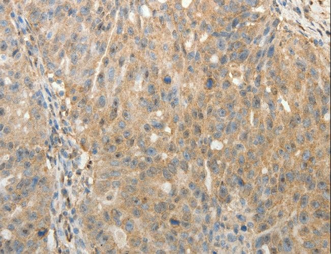 SULT1E1 / Sulfotransferase 1E1 Antibody
