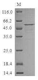 Human CRISPLD2 Protein (Recombinant 10His, N-terminus + Myc, C-terminus)
