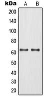 ROX / MNT Antibody (Internal)