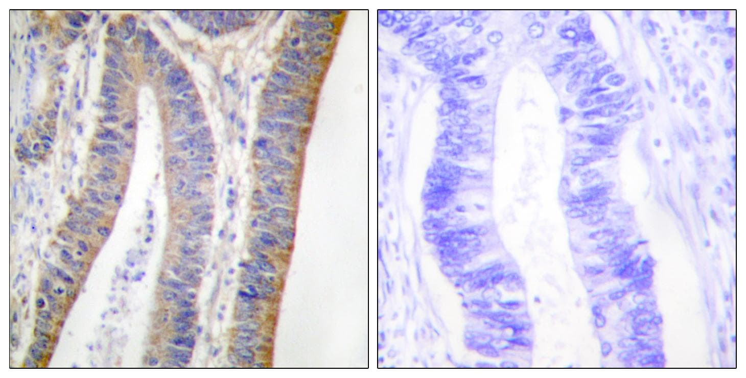 NCF1 / p47phox / p47 phox Antibody (phospho-Ser359)