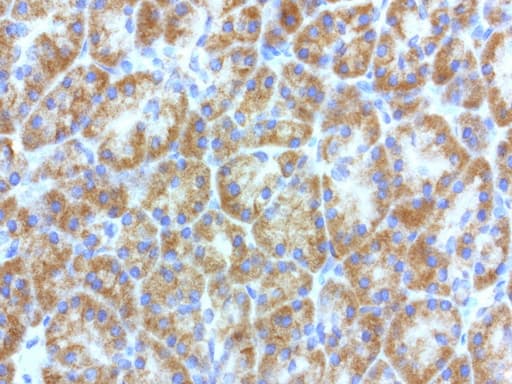 L1CAM Antibody (clone UMAB47)