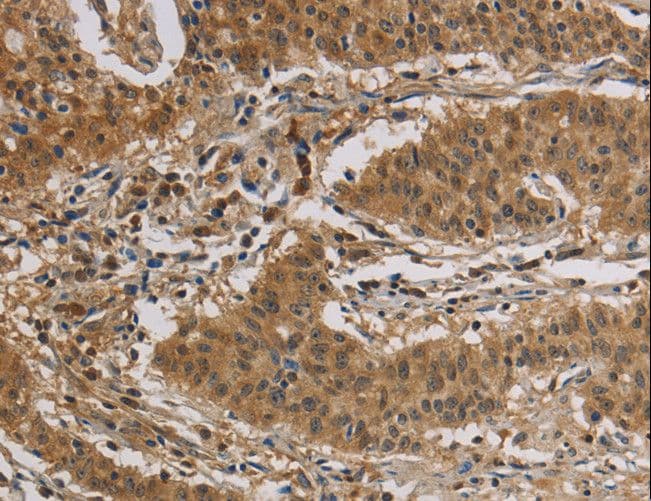 CASP3 / Caspase 3 Antibody