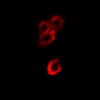 PathPlus™ Polyclonal Rabbit anti-Human ENO1 / Alpha Enolase Antibody (IHC, IF, WB)