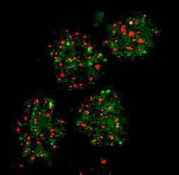 FANCD2 Antibody (N-Terminus, DY488)