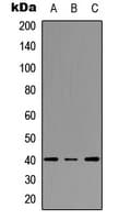 Polyclonal Rabbit anti-Human FPR3 / FPRL2 Antibody (C-Terminus, WB)