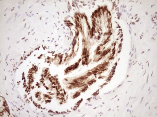 SAE1 Antibody (clone OTI6C7)