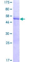 Human LRRC61 Protein (Recombinant GST)