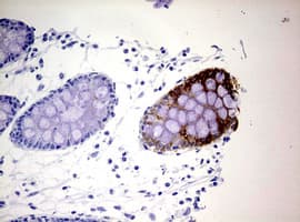 KRT20 / CK20 / Cytokeratin 20 Antibody (clone OTI5E6)