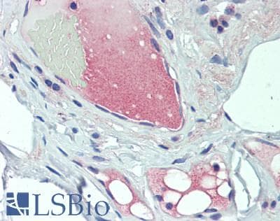 IHC-plus™ Polyclonal Rabbit anti-Human VEGFB Antibody (60-140 aa, Internal, IHC, WB)
