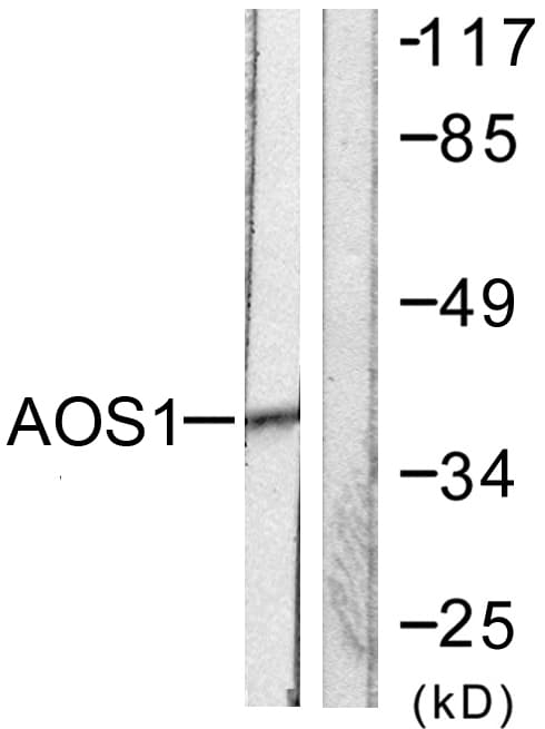 SAE1 Antibody (aa221-270)