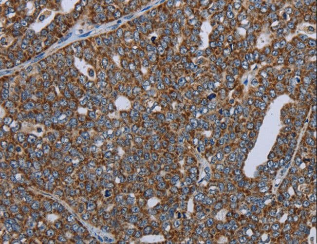 NDUFA13 / GRIM19 Antibody