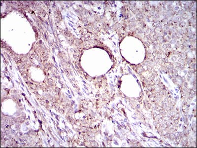 ALDH2 Antibody (aa317-517, clone 4G6A3)