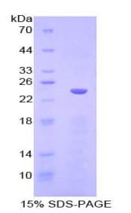 Human ILT2 / CD85 Protein (Recombinant His-T7)