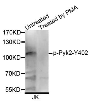 PTK2B / PYK2 Antibody (phospho-Tyr402)