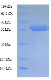 Human CASP5 / Caspase 5 Protein (Recombinant His-SUMO)
