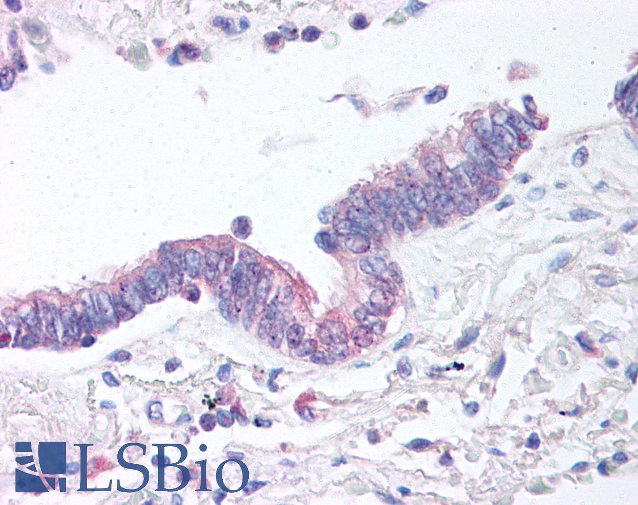 IHC-plus™ Polyclonal Rabbit anti-Human PAWR / PAR4 Antibody (aa1-15, IHC)