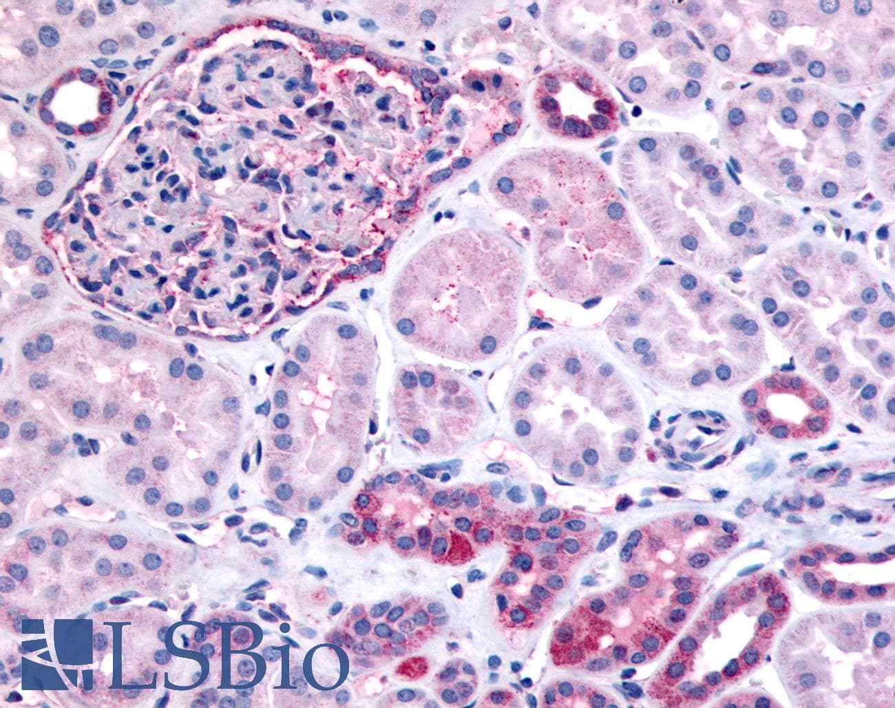 IHC-plus™ Polyclonal Rabbit anti-Human INPP5J / PIB5PA Antibody (N-Terminus, IHC)