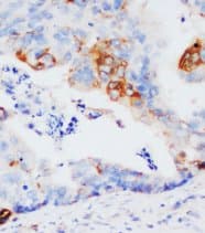 GSTP1 / GST Pi Antibody (aa197-210)