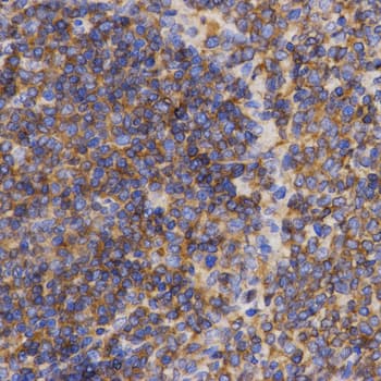Polyclonal Rabbit anti-Human PDCD10 Antibody (IHC, WB)