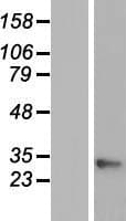 GAJ / MND1 Protein (Over-Expression Lysate Myc-DDK (Flag))