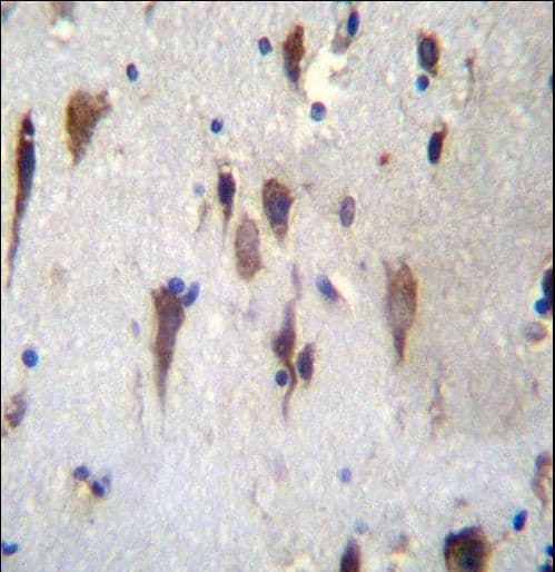 Polyclonal Rabbit anti-Human PCDH7 Antibody (aa1039-1066, IHC, WB)