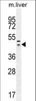IHC-plus™ HEXIM1 Antibody (aa194-222)