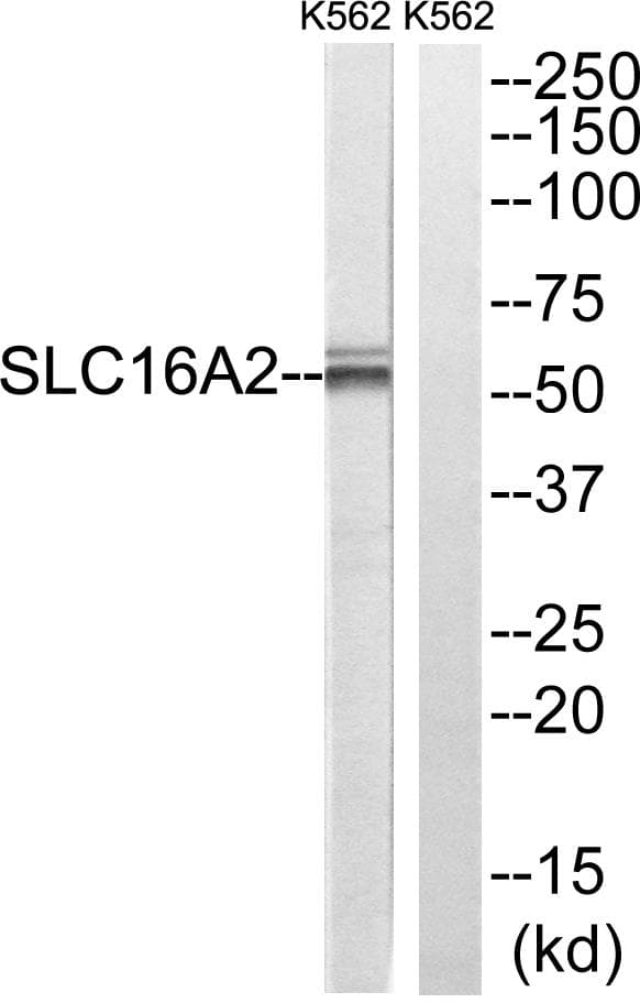 SLC16A2 / MCT8 Antibody