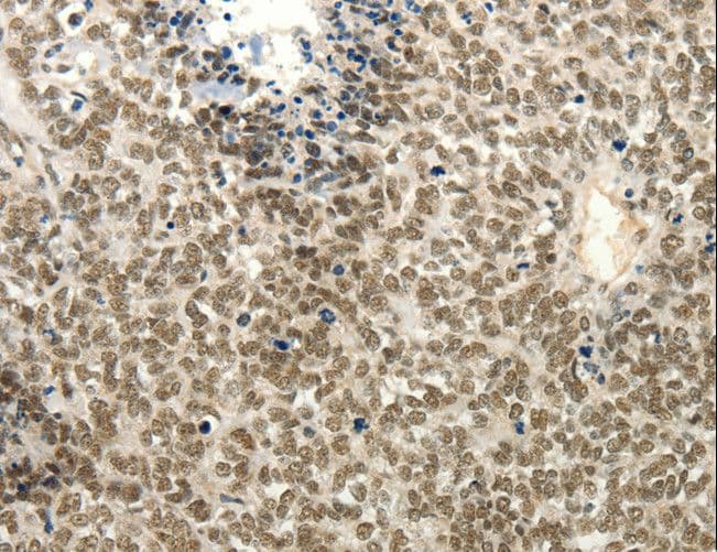 FZD10 / Frizzled 10 Antibody