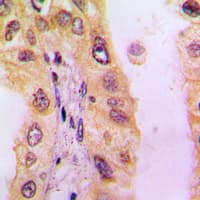 Polyclonal Rabbit anti-Human BLNK Antibody (Internal, IHC, WB)