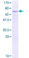 Human SMYD2 Protein (Recombinant GST)