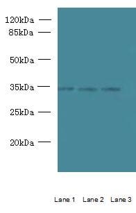 C15orf41 Antibody