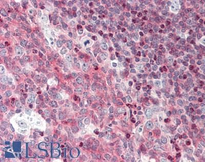 IHC-plus™ BCL11A Antibody