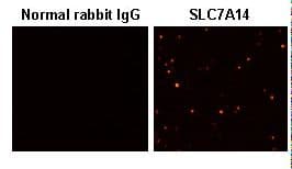 Polyclonal Rabbit anti-Human SLC7A14 Antibody (IHC, WB)