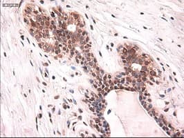 KRT18 / CK18 / Cytokeratin 18 Antibody (clone OTI5E8)