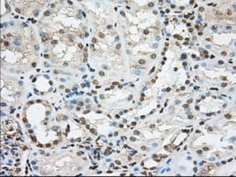 Monoclonal Mouse anti-Human ACSBG1 / hsBG Antibody (clone OTI1D8, IHC, IF, WB)