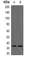 TPMT Antibody