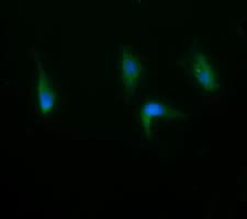 RAB21 Antibody (clone OTI6A9)