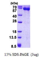 Human HSPD1 / HSP60 Protein (Recombinant His)