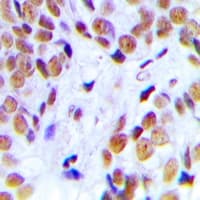 NPM1 / NPM / Nucleophosmin Antibody (C-Terminus)
