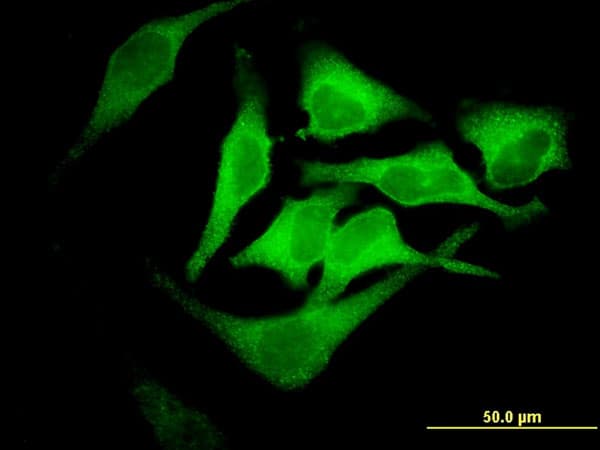 EPB42 Antibody (clone 2G12)