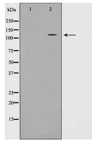 EPHA7 / EPH Receptor A7 Antibody