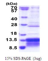 Human MUSTN1 Protein (Recombinant His)