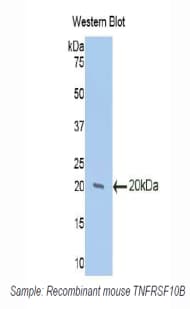 TNFRSF10B / Killer / DR5 Antibody (aa233-367)
