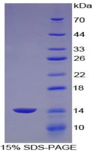 Mouse ACAN / Aggrecan Protein (Recombinant His)