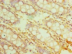 IL20RB Antibody (aa48-177)
