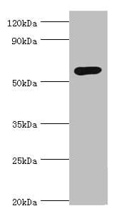 IHC-plus™ GCK / Glucokinase Antibody (aa1-300)